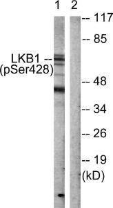 Western blot analysis of lysates from HeLa cells treated with PMA 125 ng/ml 30' using Anti-LKB1 (phospho Ser428) Antibody. The right hand lane represents a negative control, where the Antibody is blocked by the immunising peptide