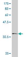 Anti-SH3BP4 Mouse Monoclonal Antibody [clone: 2B6]