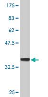 Anti-FN3K Mouse Monoclonal Antibody [clone: 4F2]