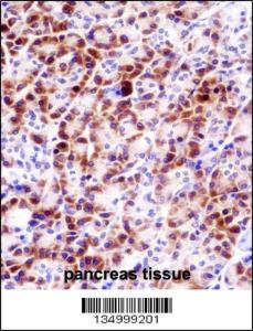 Anti-PRSS27 Rabbit Polyclonal Antibody (FITC (Fluorescein Isothiocyanate))