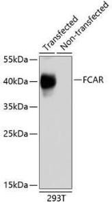 Western blot analysis of extracts of 293T cells, using Anti-CD89 Antibody (A10545). The secondary antibody was Goat Anti-Rabbit IgG H and L Antibody (HRP) at 1:10,000 dilution. Lysates/proteins were present at 25 µg per lane. The blocking buffer used was 3% non-fat dry milk in TBST