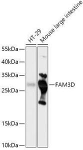 Western blot analysis of extracts of various cell lines, using Anti-FAM3D Antibody (A308559) at 1:1,000 dilution The secondary antibody was Goat Anti-Rabbit IgG H&L Antibody (HRP) at 1:10,000 dilution Lysates/proteins were present at 25 µg per lane