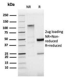 SDS-PAGE analysis of Anti-StAR Antibody [STAR/3915R] under non-reduced and reduced conditions; showing intact IgG and intact heavy and light chains, respectively. SDS-PAGE analysis confirms the integrity and purity of the antibody.