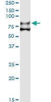 Anti-F11 Antibody Pair