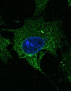 Hepa 1-6 cells, fixed with 4% PFA, stained with Anti-CD63 Antibody at a 1:50 dilution