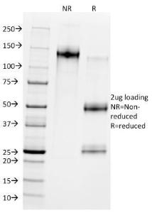 Anti-MDM2 Mouse Monoclonal Antibody [clone: SMP14]