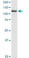 Anti-RNF20 Mouse Polyclonal Antibody