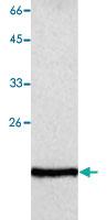 Anti-GLO1 Mouse Monoclonal Antibody [clone: 14]