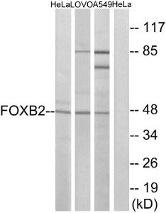 Western blot analysis of lysates from HeLa, LOVO, and A549 cells using Anti-FOXB2 Antibody. The right hand lane represents a negative control, where the Antibody is blocked by the immunising peptide