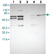 Anti-VIPAS39 Rabbit Polyclonal Antibody