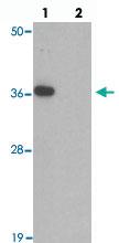 Anti-TMEM106A Rabbit Polyclonal Antibody