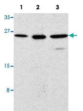 Anti-TICAM2 Rabbit Polyclonal Antibody