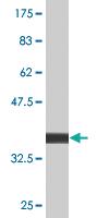 Anti-PPOX Mouse Monoclonal Antibody [clone: 2C10]