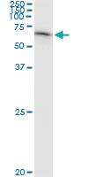 Anti-F11 Polyclonal Antibody Pair