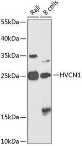 Western blot analysis of extracts of various cell lines, using Anti-HV1 Antibody (A10579) at 1:1,000 dilution