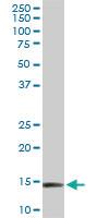 Anti-RPL36A Mouse Monoclonal Antibody [clone: 5F8]