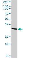 Anti-TARBP2 Rabbit Polyclonal Antibody