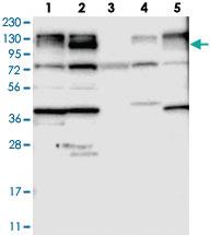 Anti-ANKIB1 Rabbit Polyclonal Antibody