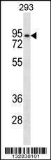 Anti-ANKRD6 Rabbit Polyclonal Antibody (HRP (Horseradish Peroxidase))