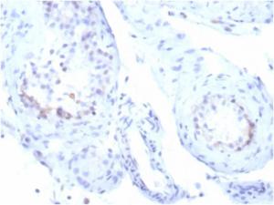 Immunohistochemical analysis of formalin-fixed, paraffin-embedded human testicular carcinoma tissue using Anti-StAR Antibody [STAR/3915R]