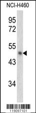 Anti-SERPINB2 Rabbit Polyclonal Antibody