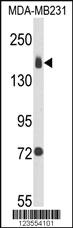 Anti-ITGA2 Rabbit Polyclonal Antibody