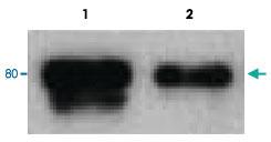 Anti-DAB1 Polyclonal Antibody