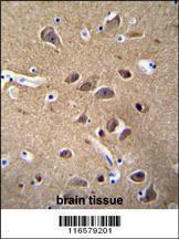 Anti-NSE Rabbit Polyclonal Antibody (Biotin)