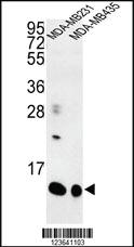 Anti-SPRR1B Rabbit Polyclonal Antibody