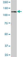 Anti-RNF20 Mouse Polyclonal Antibody