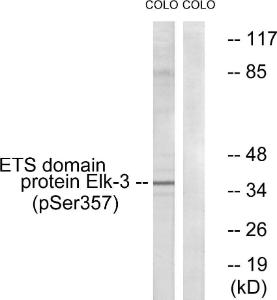 Anti-ELK3 Rabbit Polyclonal Antibody