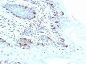 Immunohistochemical analysis of formalin-fixed, paraffin-embedded human skin using Anti-MelanA Antibody [MLANA/4475R]