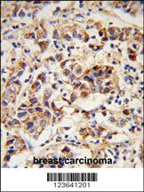 Anti-SPRR1B Rabbit Polyclonal Antibody