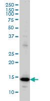 Anti-RPL36A Mouse Monoclonal Antibody [clone: 6H1]