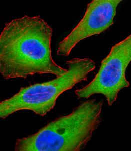 Anti-TSC2 Rabbit Polyclonal Antibody (Biotin)