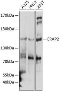 Western blot analysis of extracts of various cell lines, using Anti-ERAP2 Antibody (A10596) at 1:1,000 dilution. The secondary antibody was Goat Anti-Rabbit IgG H&L Antibody (HRP) at 1:10,000 dilution.