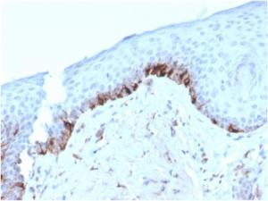 Immunohistochemical analysis of formalin-fixed, paraffin-embedded human skin using Anti-TRP1 Antibody [TYRP1/3282]