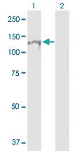 Anti-RNF20 Mouse Polyclonal Antibody