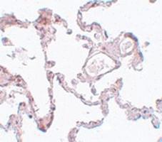 Anti-PLEKHM1 Rabbit Polyclonal Antibody