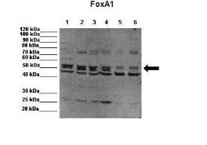 Anti-FOXA1 Rabbit Polyclonal Antibody