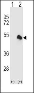 Anti-OAT Rabbit Polyclonal Antibody (Biotin)