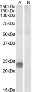 Anti-HMGA1 Antibody (A82541) (0.5 µg/ml) staining of Human Pancreas lysate (35 µg protein in RIPA buffer) with (B) and without (A) blocking with the immunising peptide. Primary incubation was 1 hour. Detected by chemiluminescence