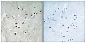 Anti-ELK3 Rabbit Polyclonal Antibody