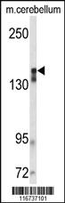 Anti-RPS19 Rabbit Polyclonal Antibody