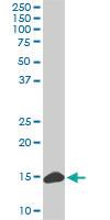 Anti-RPL36A Mouse Monoclonal Antibody [clone: 6H1]