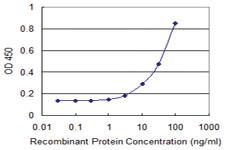 Anti-SLC2A4 Mouse Monoclonal Antibody [clone: 4A1]