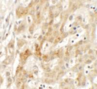 Anti-TMEM106B Rabbit Polyclonal Antibody