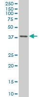 Anti-TFAP4 Mouse Monoclonal Antibody [clone: 6B1]