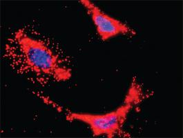 Anti-HCK + PIK3CB Antibody Pair