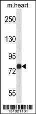 Anti-MAP4K2 Rabbit Polyclonal Antibody (HRP (Horseradish Peroxidase))